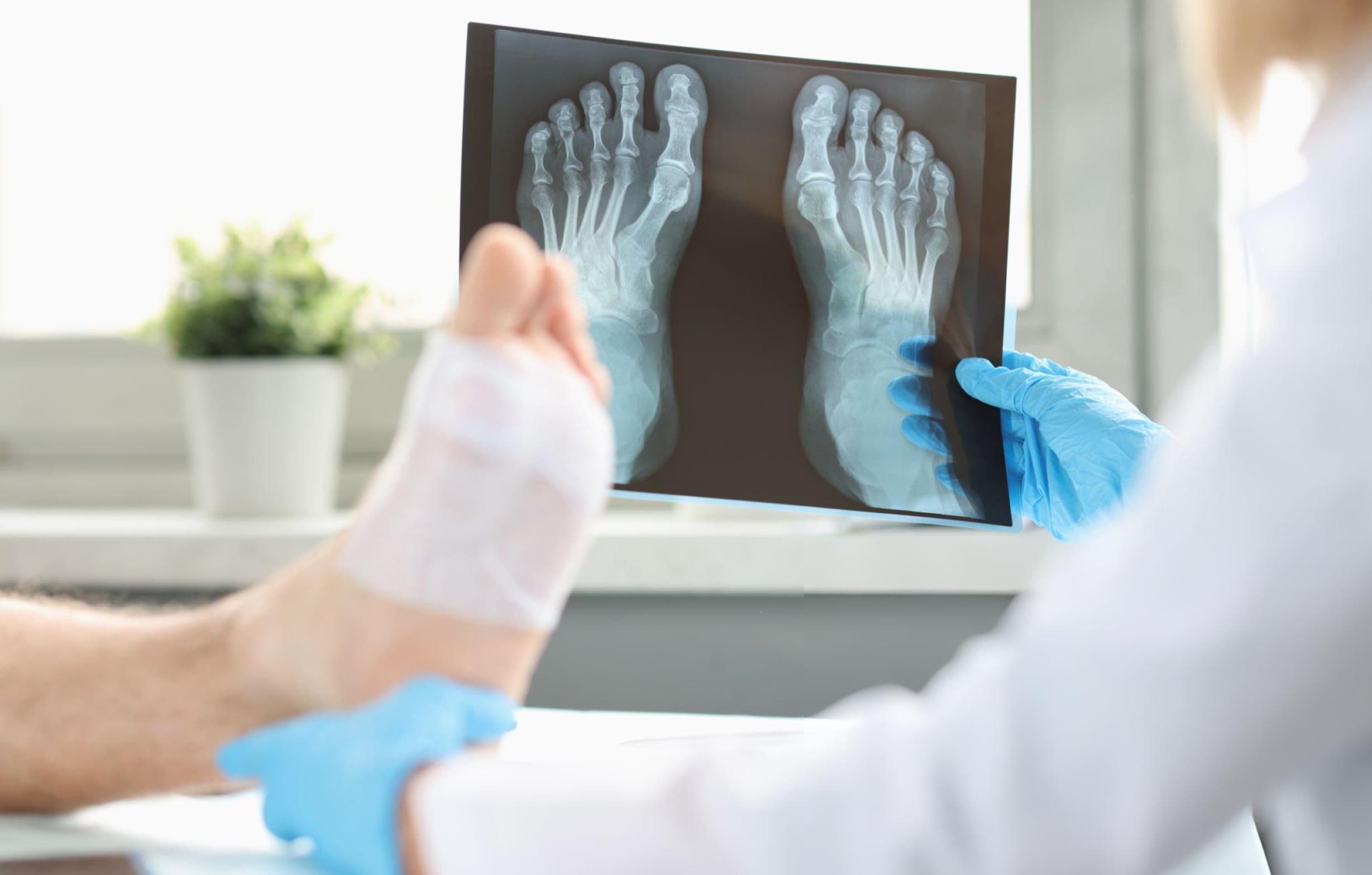 Ankle & Foot Surgery — Ankle and foot orthopaedic surgery